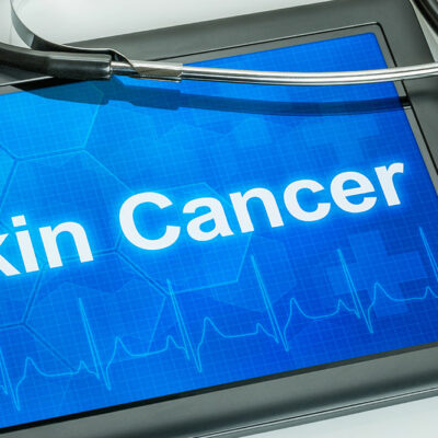 Skin cancer &#8211; Types and warning signs