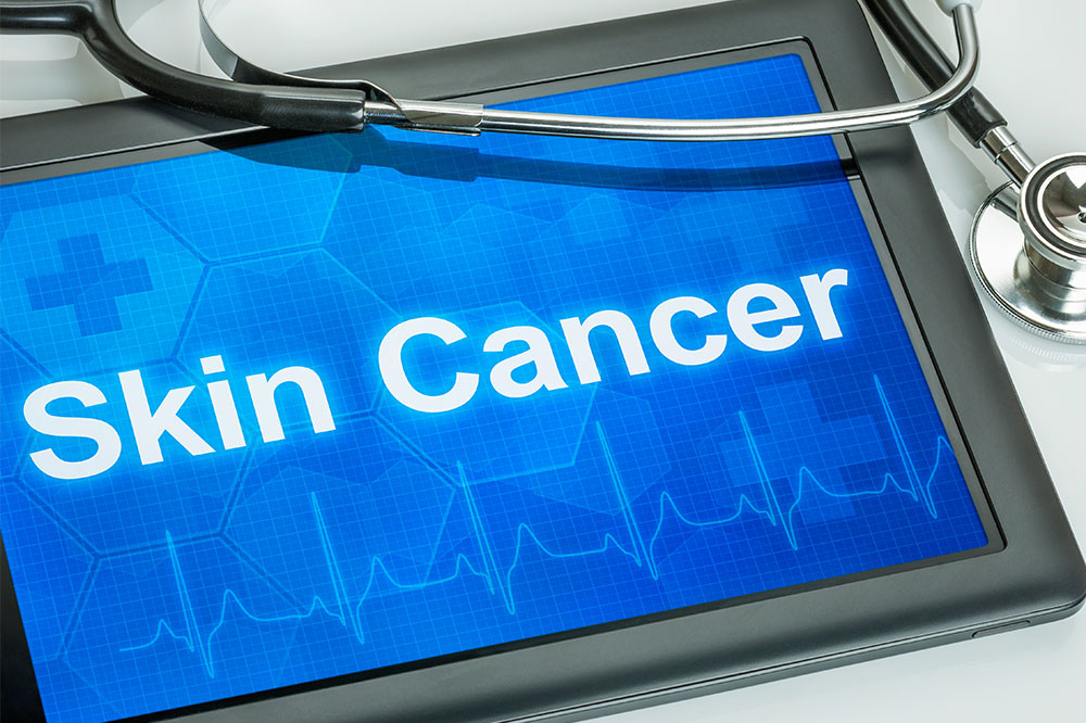 Skin cancer &#8211; Types and warning signs