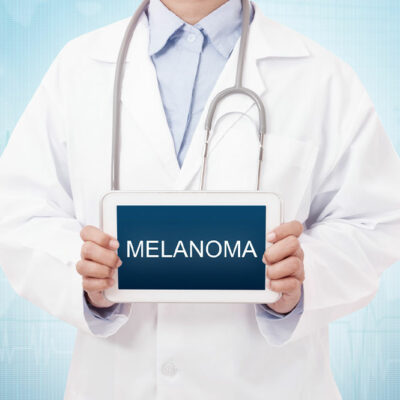 3 effective tips for dealing with melanoma