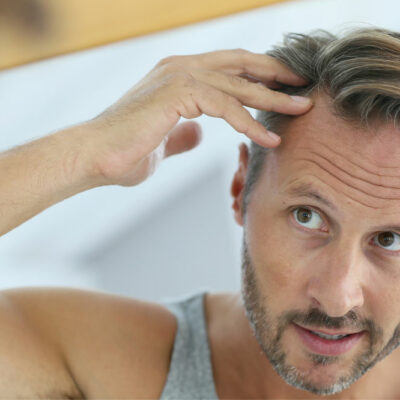 7 Medical Conditions That Can Trigger Hair Loss