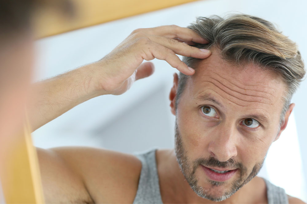 7 Medical Conditions That Can Trigger Hair Loss