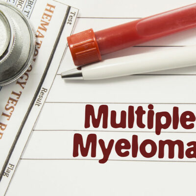 7 Warning Signs and Symptoms of Multiple Myeloma