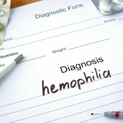 8 signs and symptoms of hemophilia