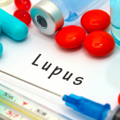 Avoid These 12 Triggers to Manage Lupus