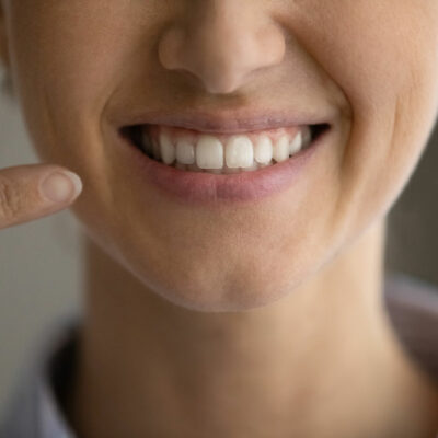 Easy remedies to whiten teeth at home