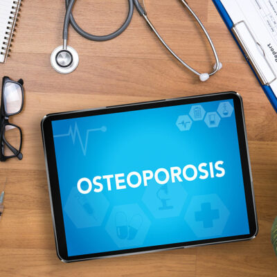 Follow these eating habits and other tips to manage osteoporosis