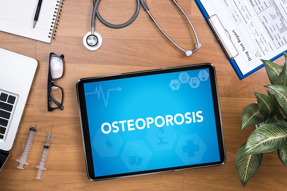 Follow these eating habits and other tips to manage osteoporosis