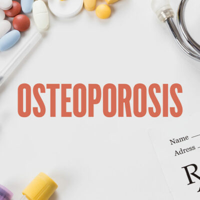 Natural Factors and Health Conditions that Increase the Risk of Osteoporosis