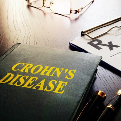 Warning signs of Crohn&#8217;s disease