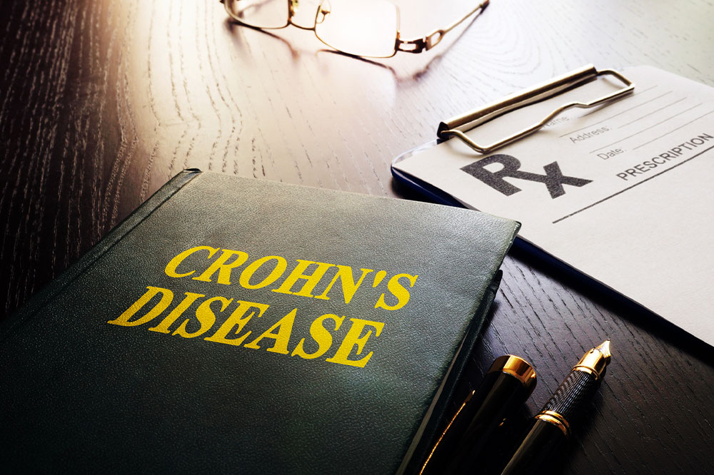 Warning signs of Crohn&#8217;s disease